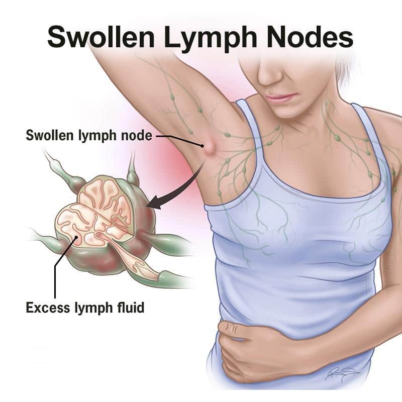 Herbal Lymph Care Patch