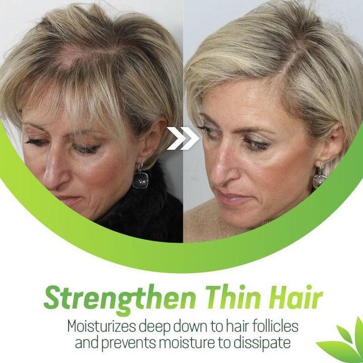 7X Rapid Growth Hair Treatment