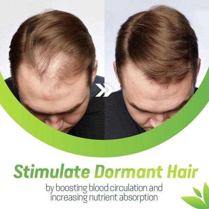 7X Rapid Growth Hair Treatment
