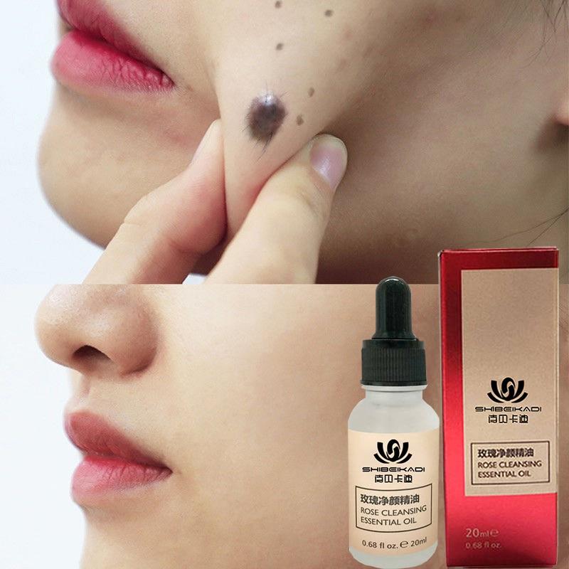 Organic Skin Tag Removal Serum