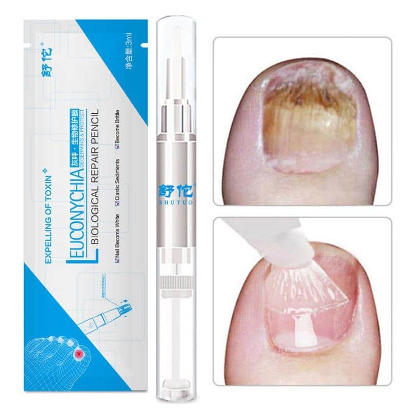 Fungus Nail Repair Pen Toenail Nail Care Treatment