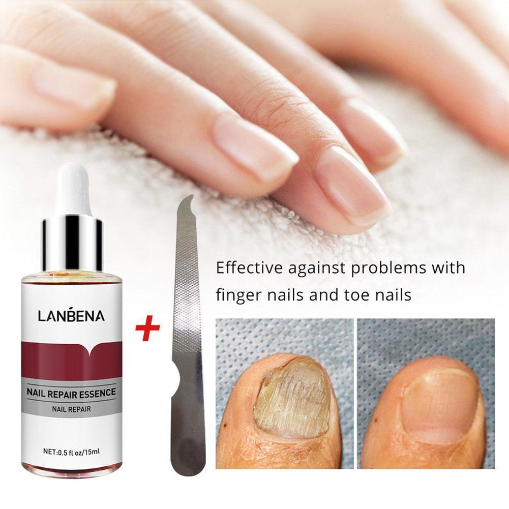 LANBENA-Nail Repair Serum