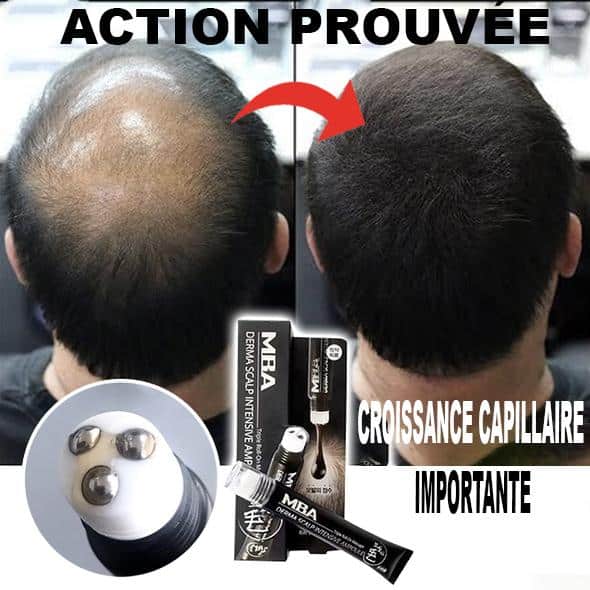 Hair regrowth serum in roll-on