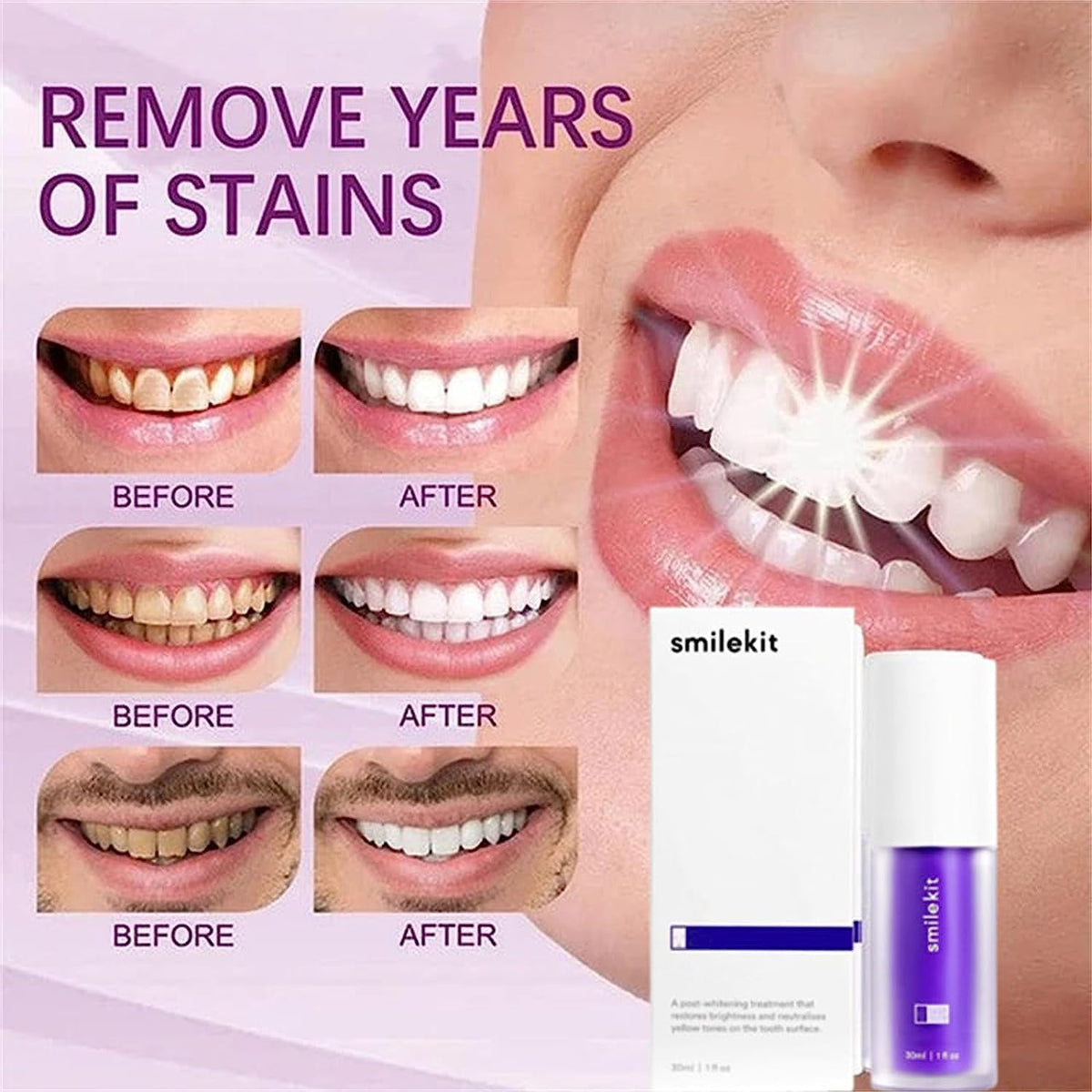 Hismile Purple Whitening Toothpaste