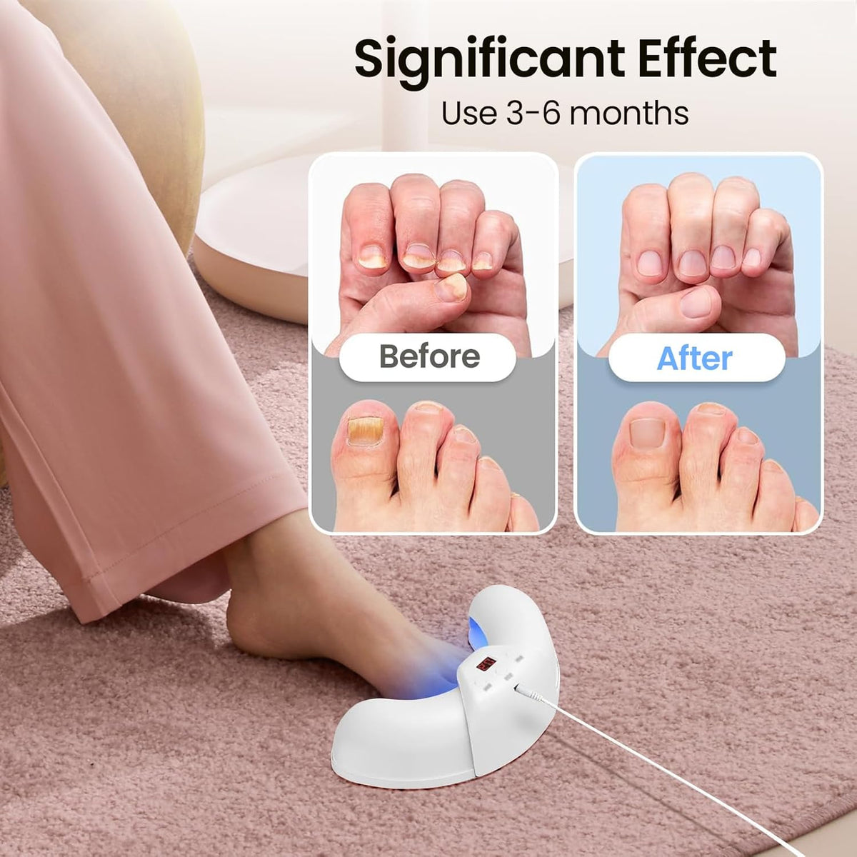 Okita Nail Fungus Lights