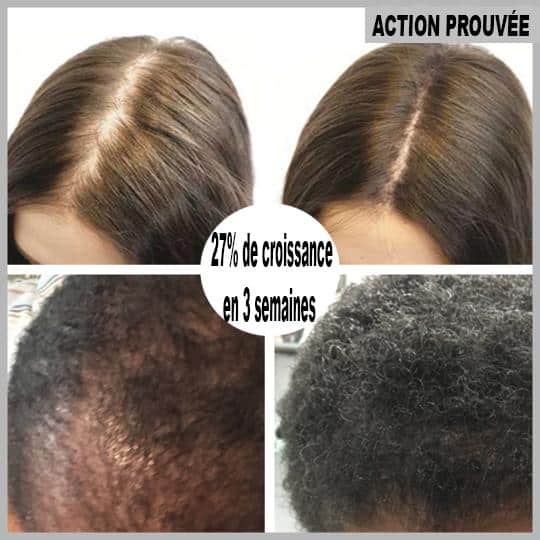 Hair regrowth serum in roll-on