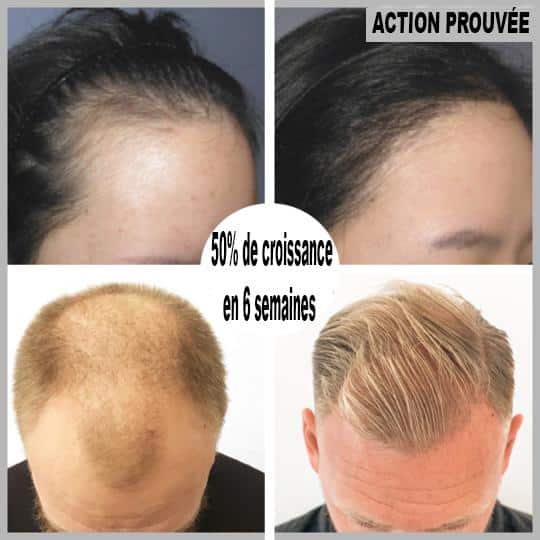 Hair regrowth serum in roll-on