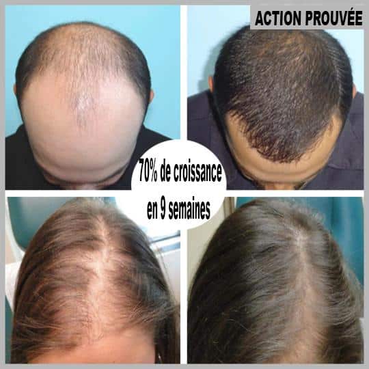 Hair regrowth serum in roll-on