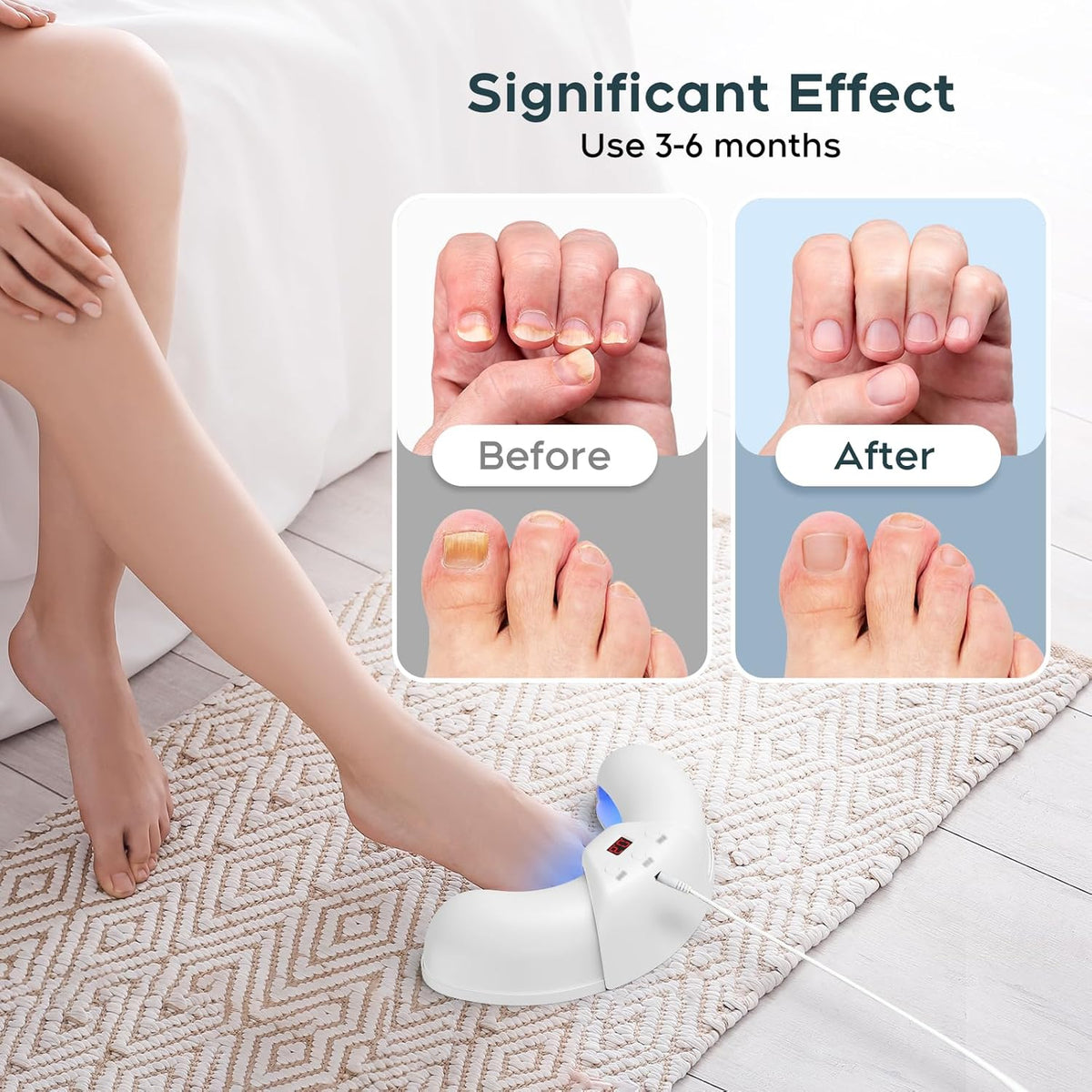 Okita Nail Fungus Lights