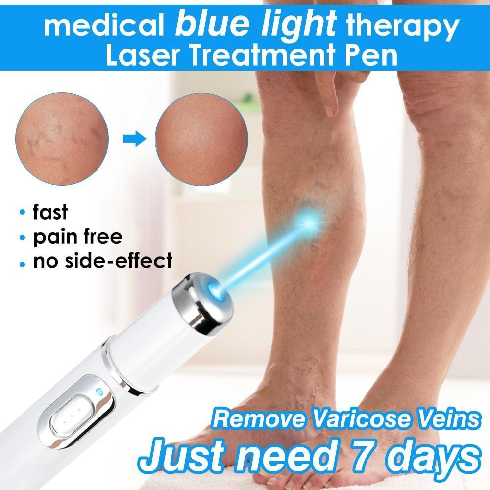 BlueLight™ Therapy Pen for Varicose Veins
