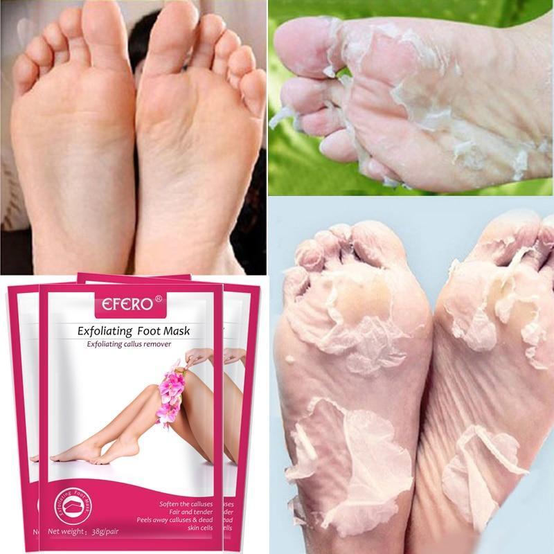 BabySkin Ultimate Foot Peeling Mask