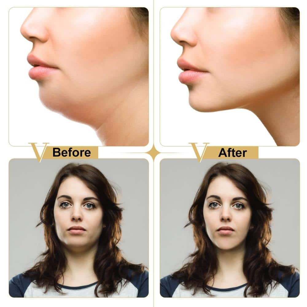 Contouring V-Shape Face Mask – Hydrating & Firming Support