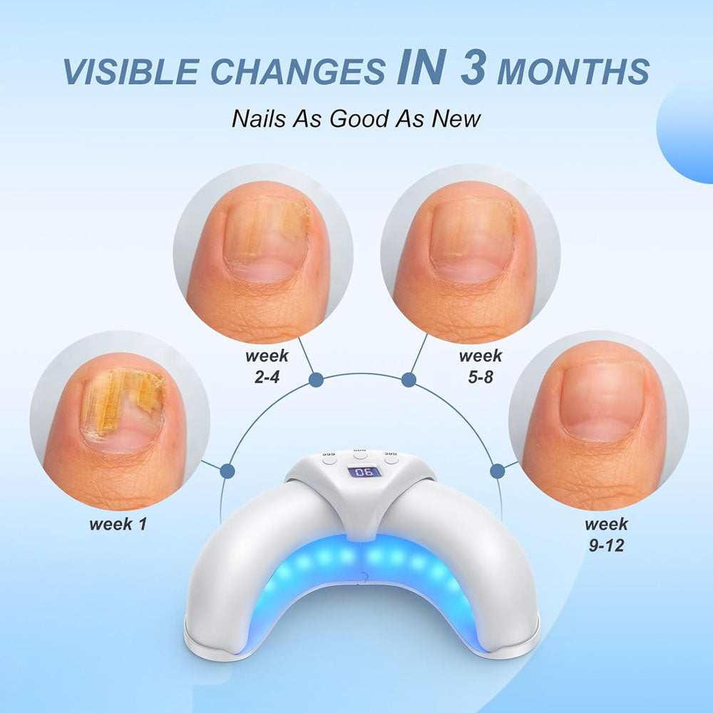 Okita Nail Fungus Lights