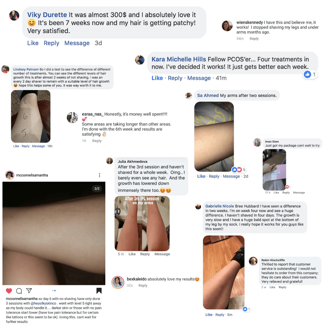 Laser Hair Removal Handset