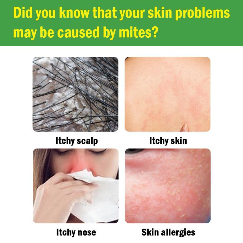 Herbal Dust Mite Natural Treatment