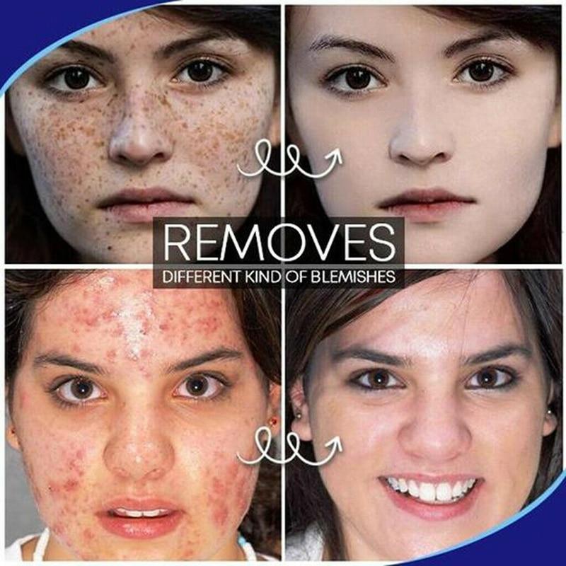 Pro.W Blemish Mole Cream
