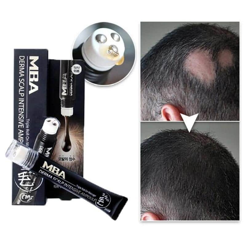 Scalp Intense Roll-on Hair Growth Serum