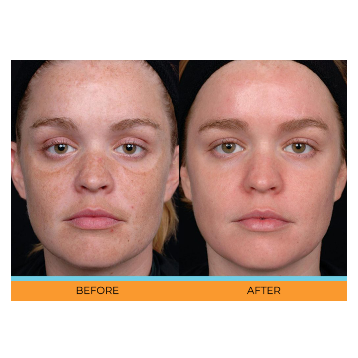 Sauvasine™ Turmeric Dark Spot Serum