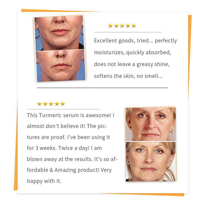 Sauvasine™ Turmeric Dark Spot Serum