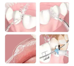 FlossyFresh Hydropulseur portable cordless dental cleaner, rechargeable oral irrigator with 3 modes and 4 nozzles