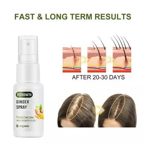 Anti hair loss spray