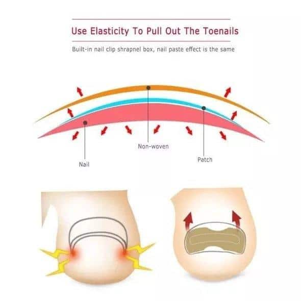 Glue Free Toenail Patch