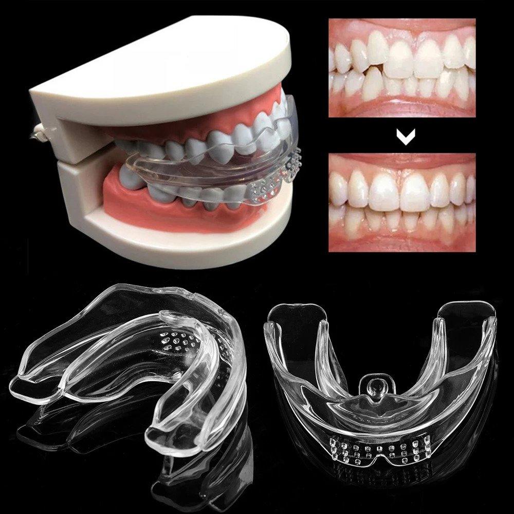 Dental alignment splint
