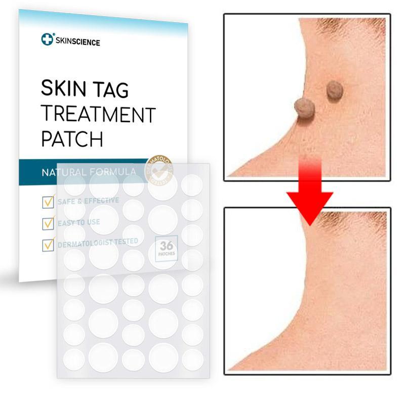 Skin Tag Removal Patch