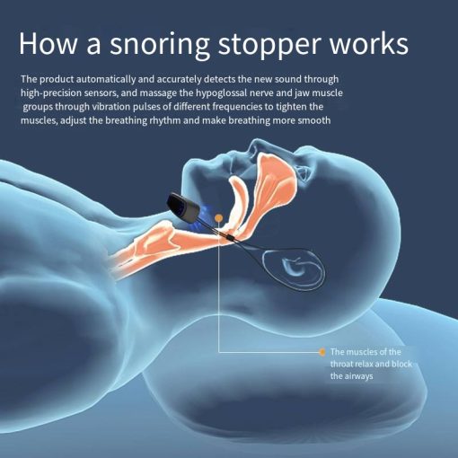 Effective anti-snoring device