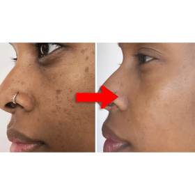 Lunavia brown anti-blemish soap with kojic acid